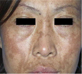 �ƺְߵĲ���