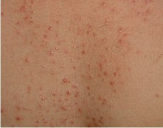 ����ë����