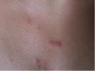 ë���׽ǻ�֢