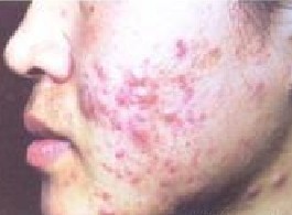 ë���׵�֢״