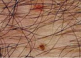 Ů��ë����