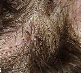 ��������ë����