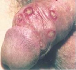 ��ֳ��ë����֢״