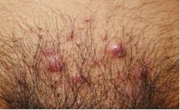 ��ë����