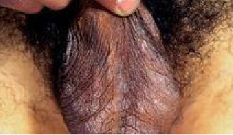 ����ë����