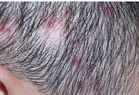 ͷƤë���ײ���