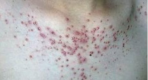 �������Ӿ�ë����ͼƬ