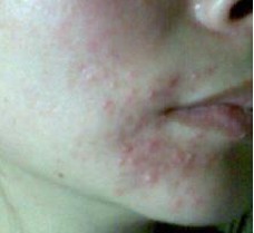 �沿Ƥ������