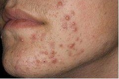 �沿ë��������