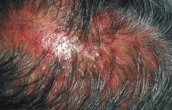 ͷƤë��������