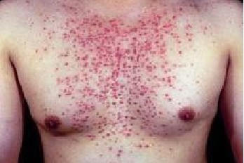 �������Ӿ�ë����