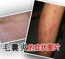 ë���׵�ͼƬ