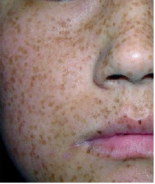 �ƺְߵĻ���