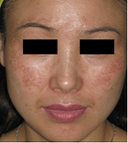 �ƺְߵ��γ�