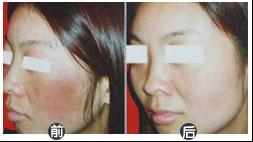 ��������Ƥ�ף�ӭ��2012�Ĳ�����һ