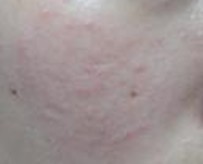 ��������Ƥ������������