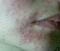 Ƥ��������������Щ����Ĺ���