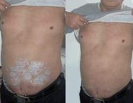 �ϲ�ţƤѢ�������ҽԺ