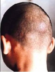 ë��������