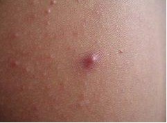 ë���ײ���