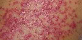 ë��������