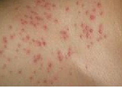 ë���׵�Σ��