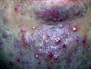 ë���׵�Σ��