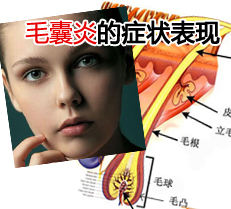 ë���׵�֢״