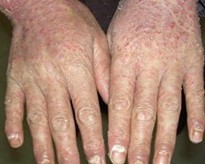 �Ĵ�Ԥ�����ֲ���м�����ٸ���