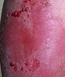 ��Ƥ����ţƤѢ��֢״����