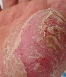 ������м������ʲô����֢