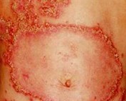 �׻�ţƤѢ����Ⱥ