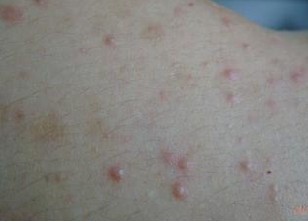 ë���׵�Σ��