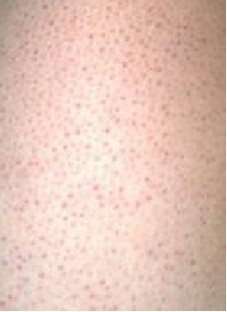 ��ë��ë����