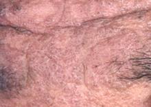 ë���׵ĳ�ʶ