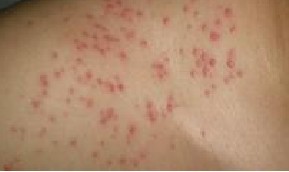 ë���׵������ͷ�չ