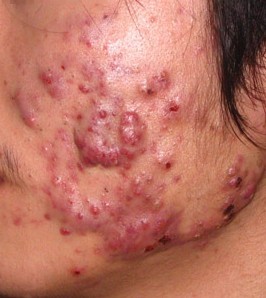 ë���׻ᴫȾ��