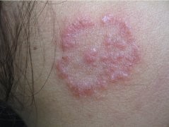 ����ë����