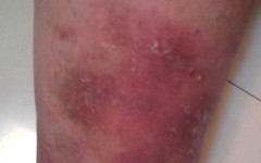 ţƤѢ�ķ�������Ӧ����