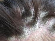 ţƤѢ���ߵ�ͷ������