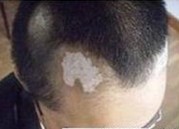 ��������ȫ�����