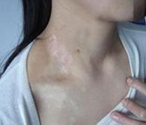 Ů�Ի�����Ĳ���