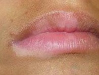 �������֢״ͼƬ