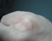 ���緢����ǰ��