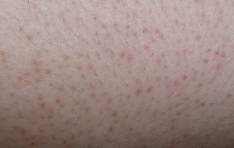 ����ë�ҽǻ���