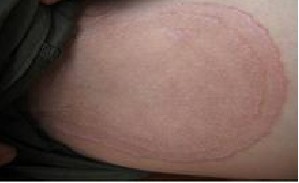 �������ë�ҽǻ���