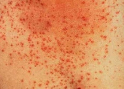 ë�ҽǻ�������