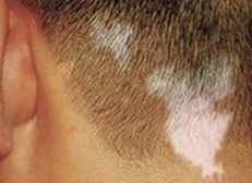 ����Բ�ͬȺ���Σ��