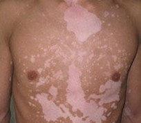 ��ư������Ƶķ���