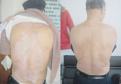 ţƤѢ�ٴ�Ȭ�����Ԥ��